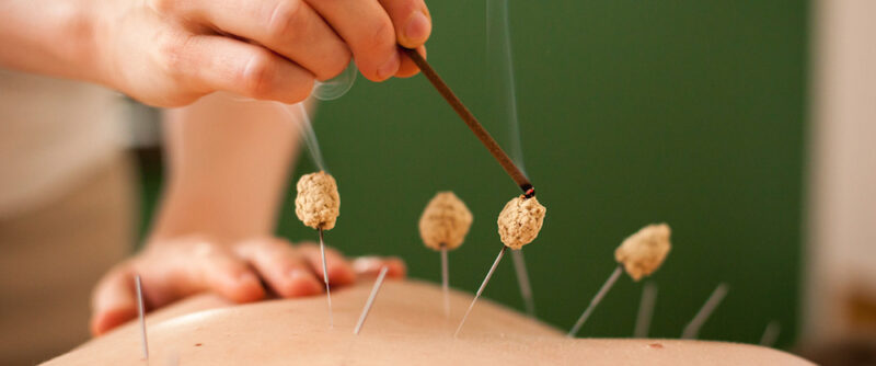 moxibustion